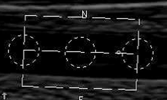 Femoral Artery Atherosclerosis Is Associated With Physical Function Across the Spectrum of the Ankle Brachial Index – The San Diego Population Study