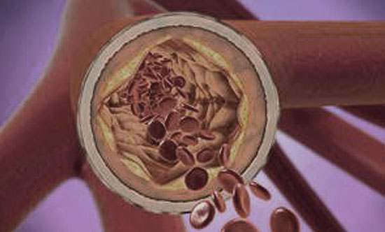 Cardiovascular fat in women at midlife: effects of race, overall adiposity, and central adiposity. The SWAN Cardiovascular Fat Study